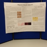 Biomedical science poster regarding Muscular dystrophy